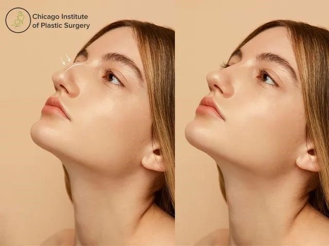 rhinoplasty surgery near me